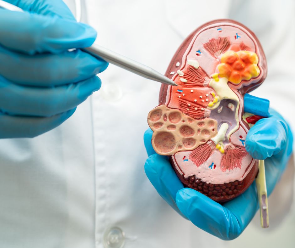 neuropédiatrie syndrome de Joubert